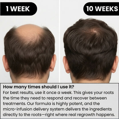 PrimalGrowth™ Hair Regrowth System